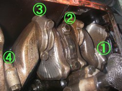 trablock5.jpg